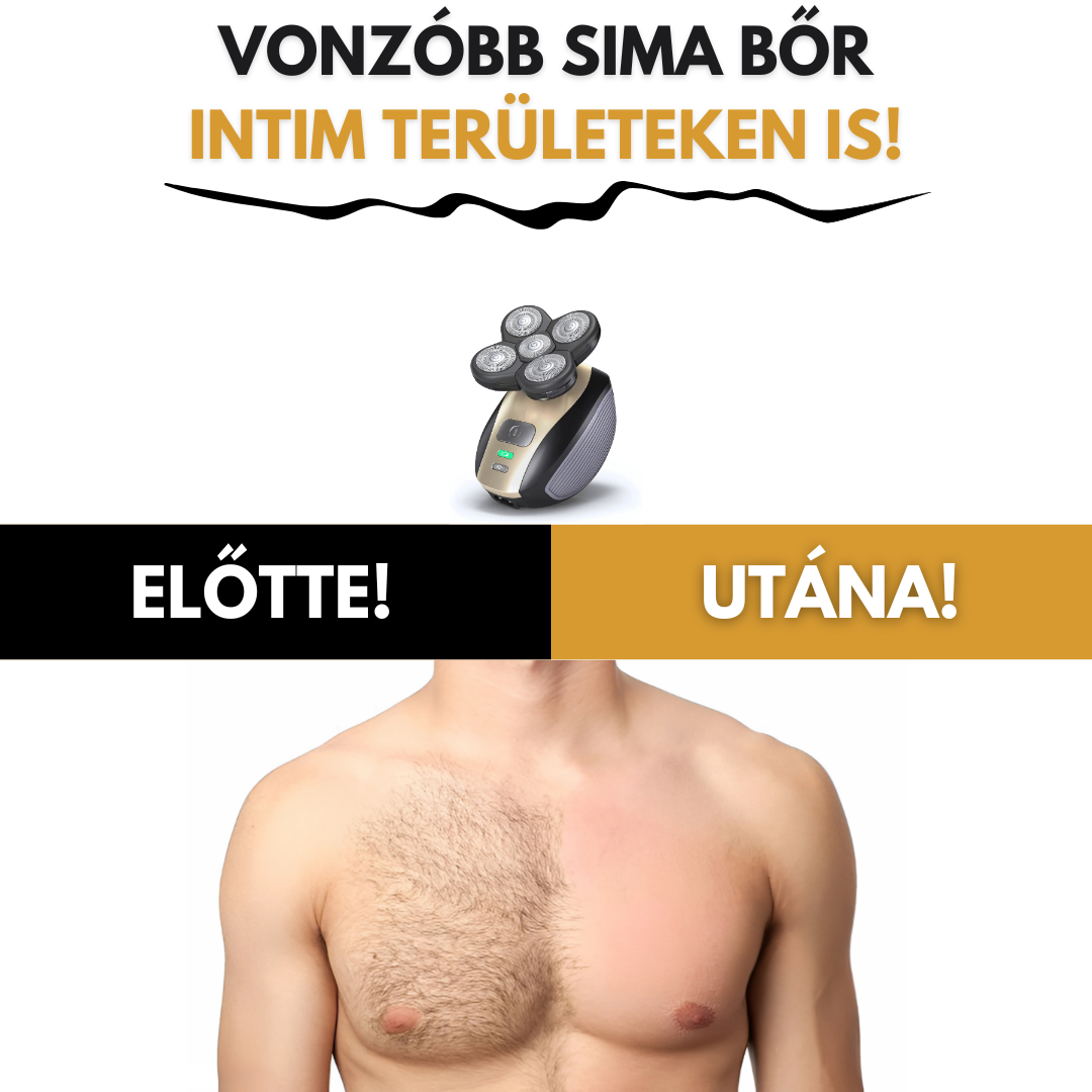 GentlCare 5 az 1-ben TeljesTest Borotva
