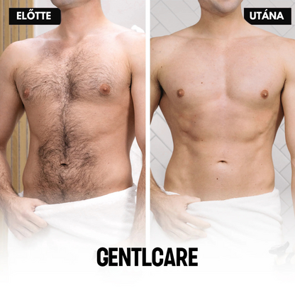 GentlCare 5 az 1-ben TeljesTest Borotva
